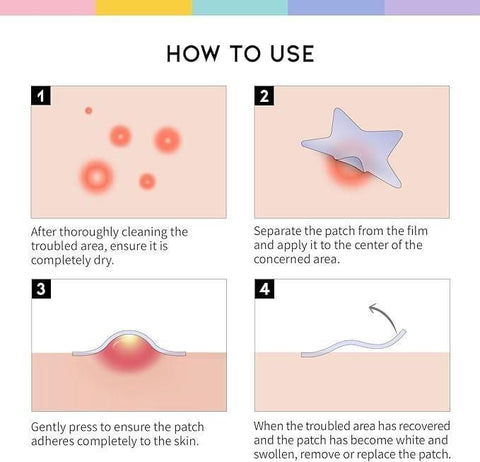 30 Pcs Pimple Patches