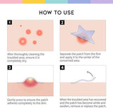 30 Pcs Pimple Patches