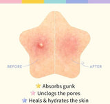 30 Pcs Pimple Patches